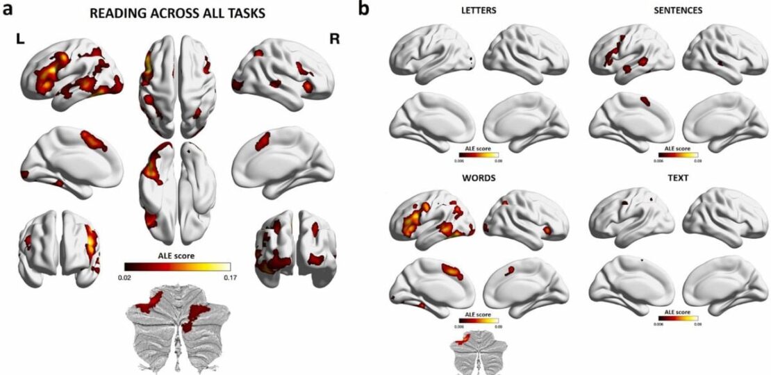 Brain_-_F_1746511765963.jpg